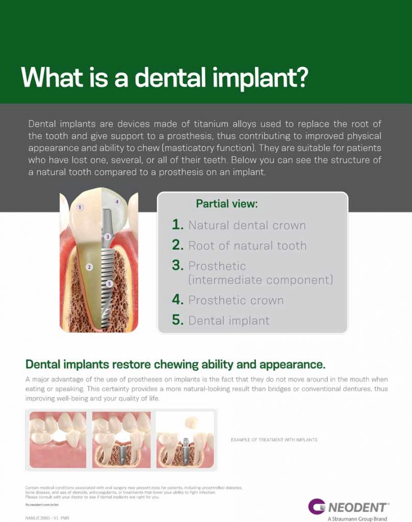 Dental Implants (3D Imaging)