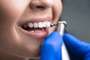 Navigating Your First Dental Appointment After a Long Hiatus: Steps to Success