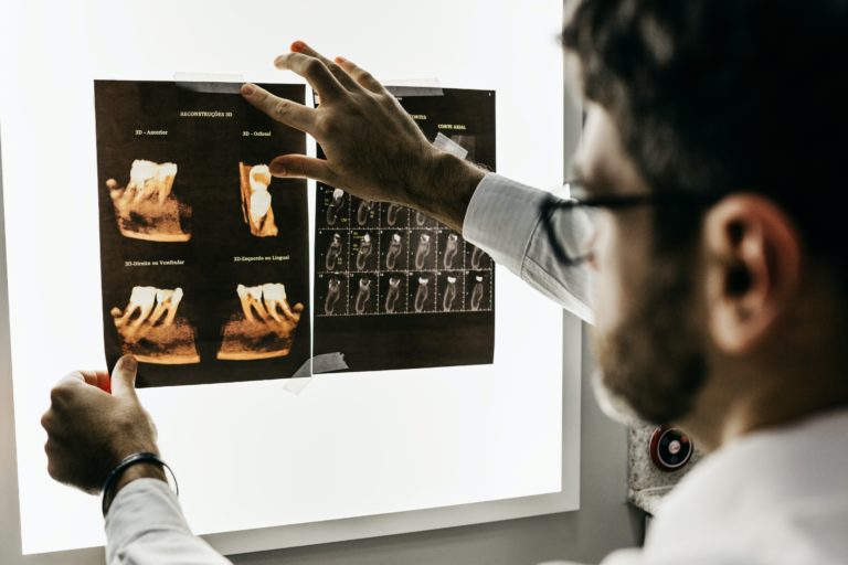A dentis looking at an x-ray