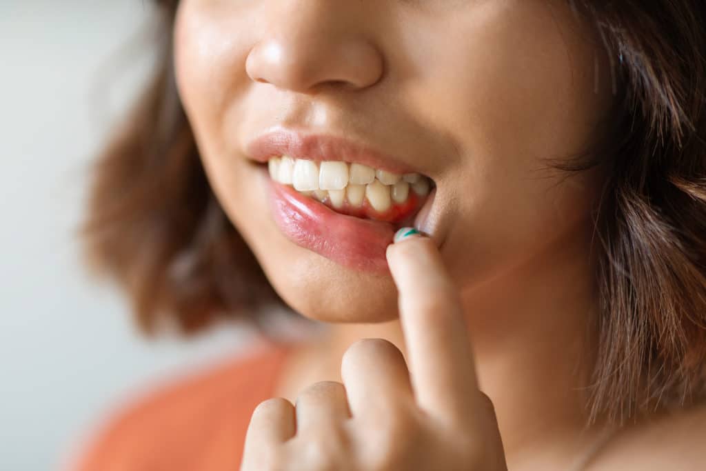 Understanding Gum Disease: From Gingivitis to Periodontal Disease
