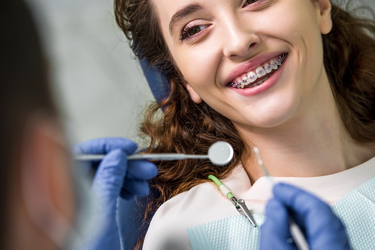 Everything You Need to Know About Teeth Braces