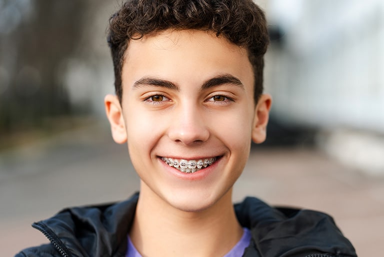 Cost of Dental Braces