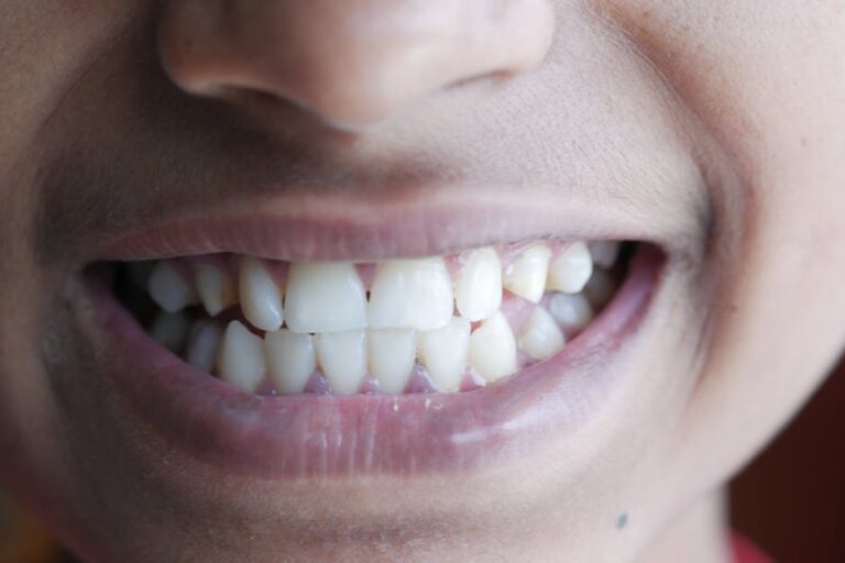 person with a bright, healthy smile and straight white teeth - Can a Sinus Infection Cause Tooth Pain?
