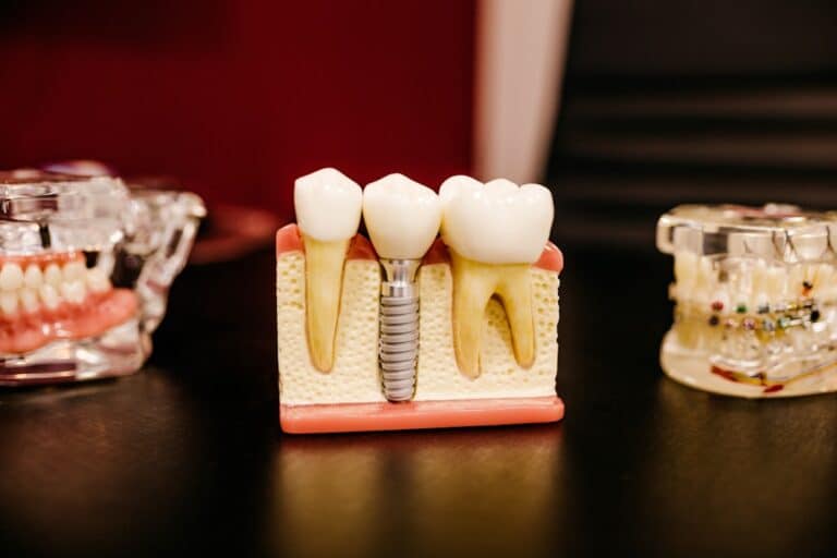 affordable dental implants pa