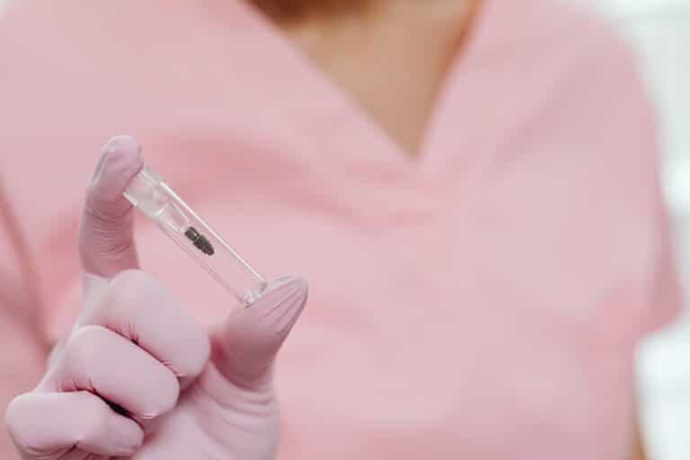 dental implants