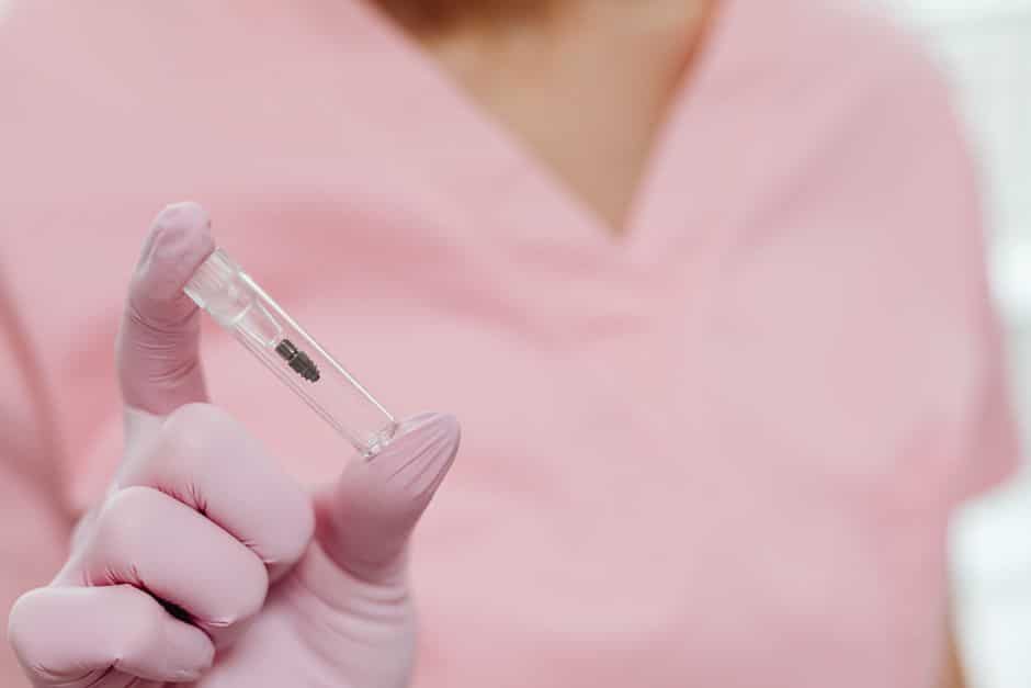 dental implants