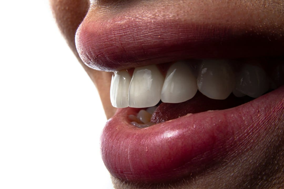 what are dental implants