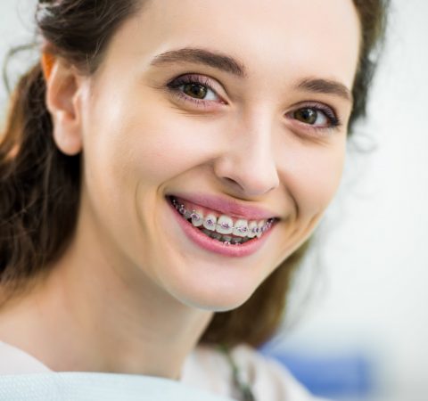 close up of happy woman with braces on teeth smiling in dental clinic